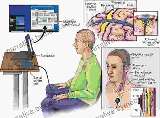 Diagram Of Neuralink Brain Computer Interface Implanted In A Human Brain Elon Musk And The Quest For A Fantastic Future Young Readers Edition