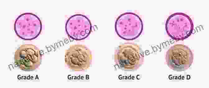 Embryologist Assessing Embryo Quality Standard Operational Procedures In Reproductive Medicine: Laboratory And Clinical Practice (Reproductive Medicine And Assisted Reproductive Techniques Series)